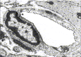 debbage-figure01