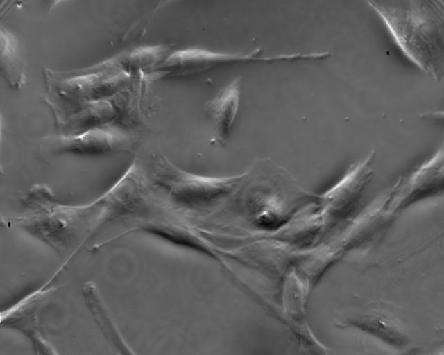 fibroblast_B_SP