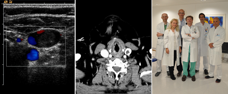 Neue Erkenntnisse zur Diagnose einer tiefen Armvenenthrombose 