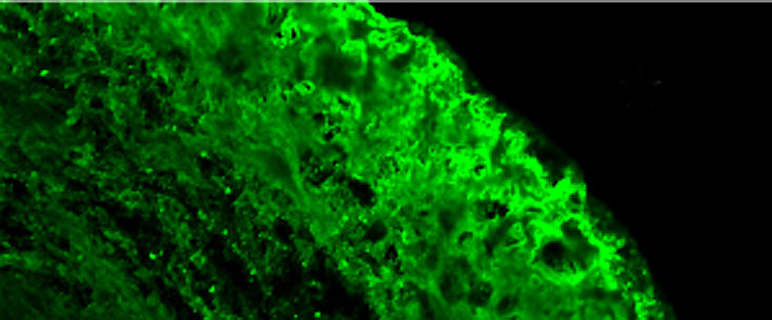 Die Immunologie der Fibrosen