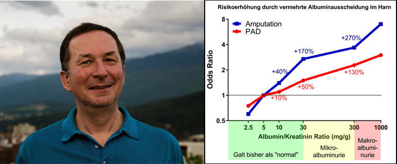 Risikofaktoren für die „Schaufensterkrankheit“:  Mega-Studie bringt neue Erkenntnisse