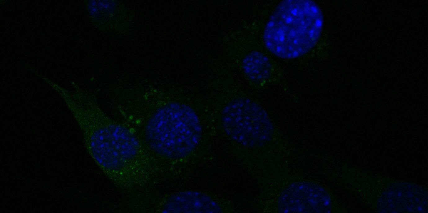 Eine unerwartete Rolle der Autophagie bei Morbus Crohn