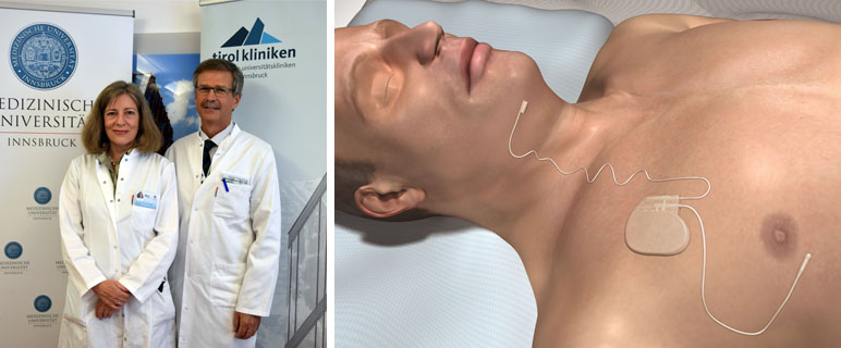    Innovative Therapie: Erste Zungenschrittmacher implantiert 