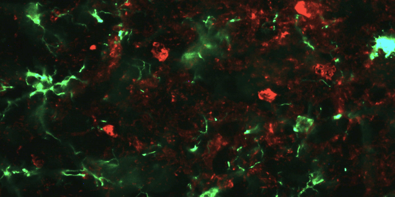 Neurowissenschafterin Stefanova erhält Forschungsförderung von der Michael J. Fox-Stiftung für Parkinson-Forschung