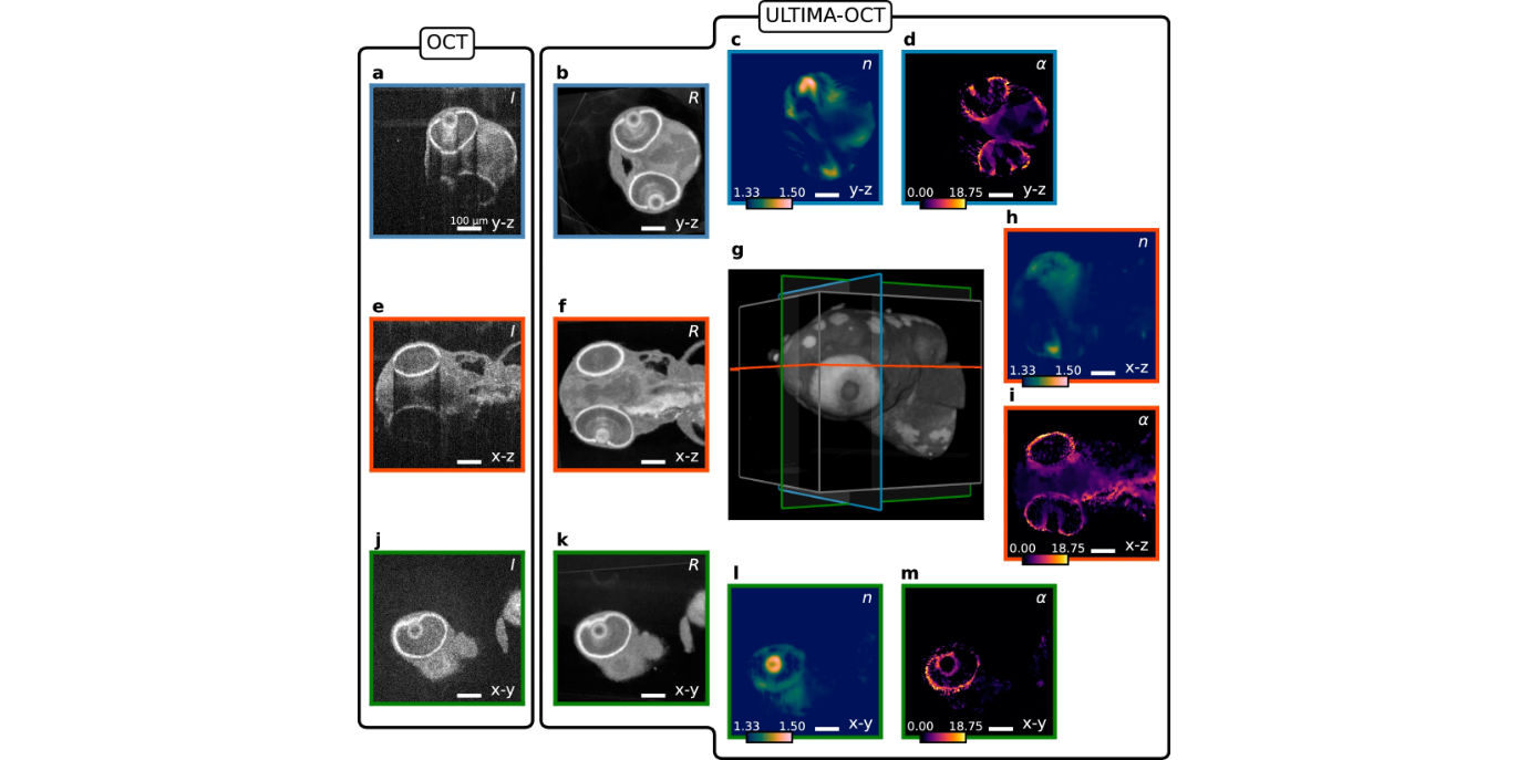 Ultraschall-Manipulation ermöglicht optische tomographische Bildgebung