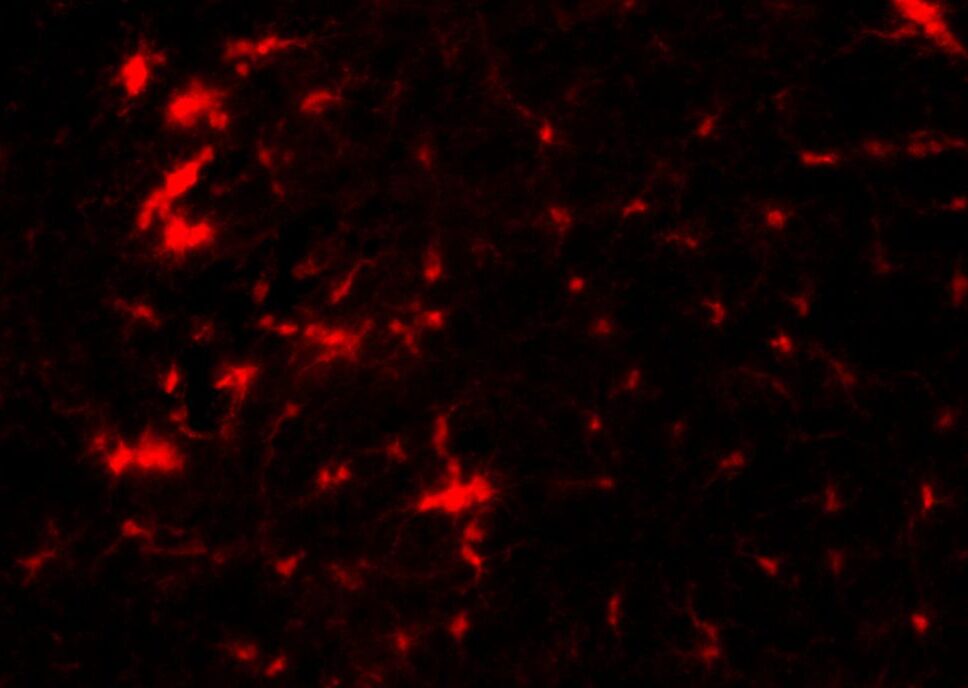 NLRP3-Hemmer Dapansutril zeigt vielversprechendes Potenzial für die Therapie von Parkinson und MSA